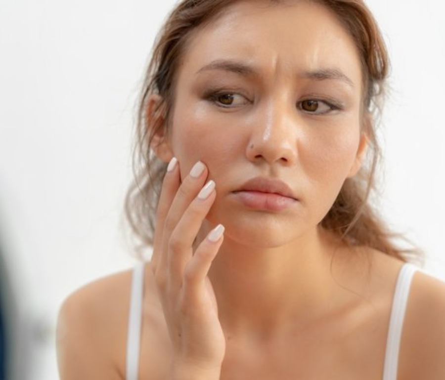 Sau kỳ nghỉ Tết với lịch sinh hoạt đảo lộn, thức khuya, ăn nhiều đồ dầu mỡ và ít chăm sóc da đúng cách, làn da thường rơi vào trạng thái quá tải