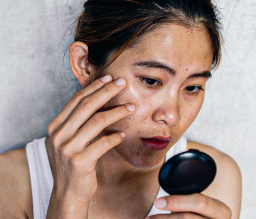 Một trong những yếu tố khiến skincare tại nhà trở nên hạn chế chính là khả năng làm sạch sâu